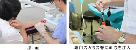 再生医療の最先端 CGF治療