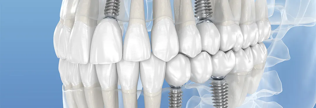 ご希望に沿った提案や難症例への対応が可能