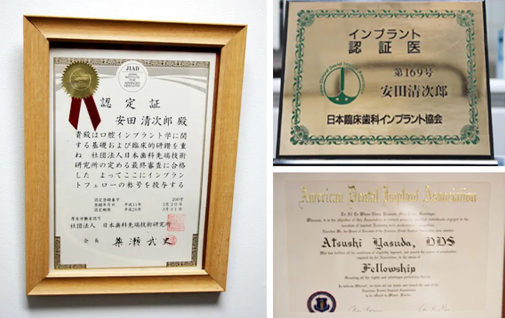 インプラント認定医による治療