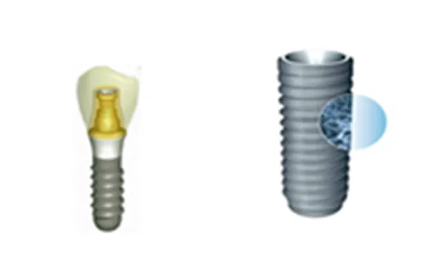 「ノーベル・バイオケア社」のインプラントです。