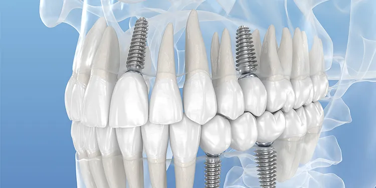 ご希望に沿った提案や難症例への対応が可能