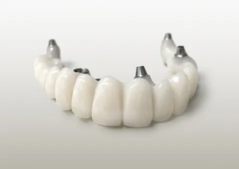 プロビ（仮歯）