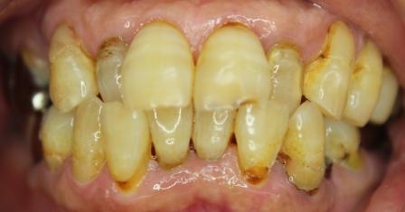 始まりは一般治療から