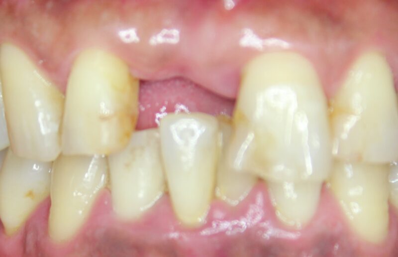 満面の笑みです（＾－＾）