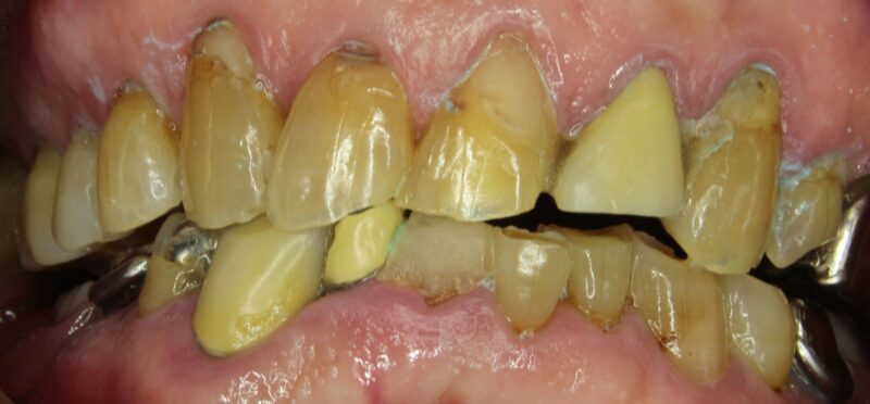 こんなに綺麗になりました❤