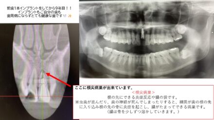 口腔状態良好!